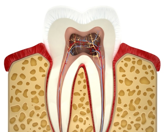 Animated toth showing damage that requires pulp therapy