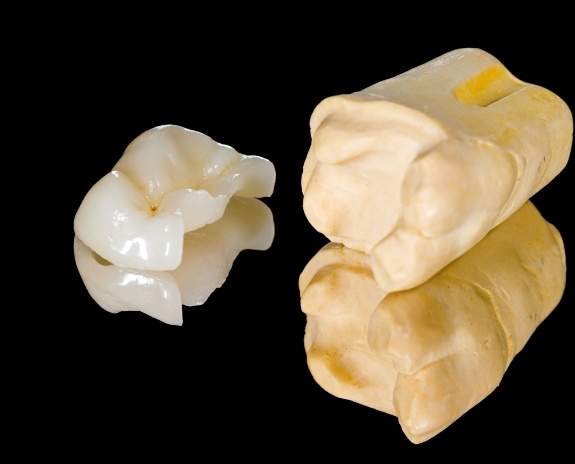 Model tooth and dental restoration