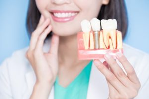 dentist holding a model of dental implants in Cherry Hill 